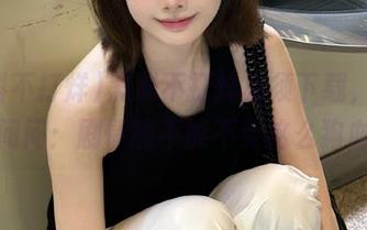 First Image