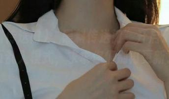 First Image