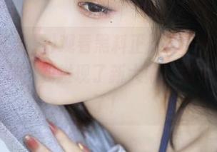 First Image